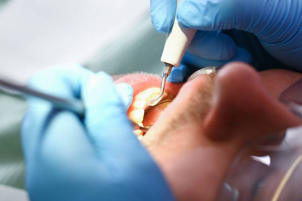 Best Pediatric Emergency Dentist in Sugar City, ID